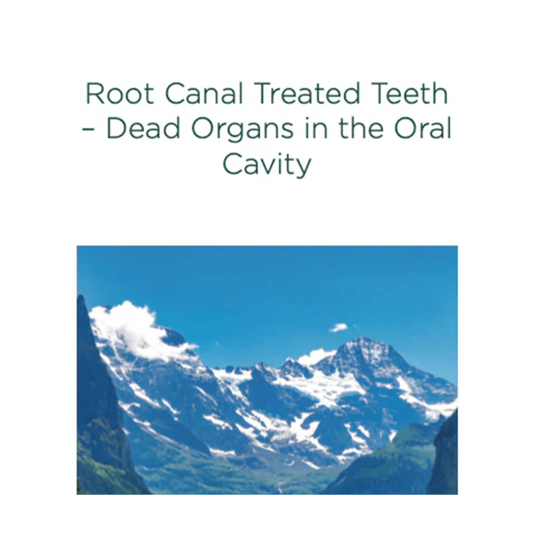 770430_root-canal-treated-teeth.webp
